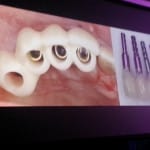 AACD 2013 Dental Technology Presentation