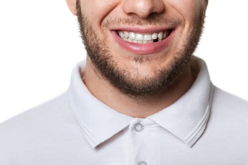 dental implants Mississauga