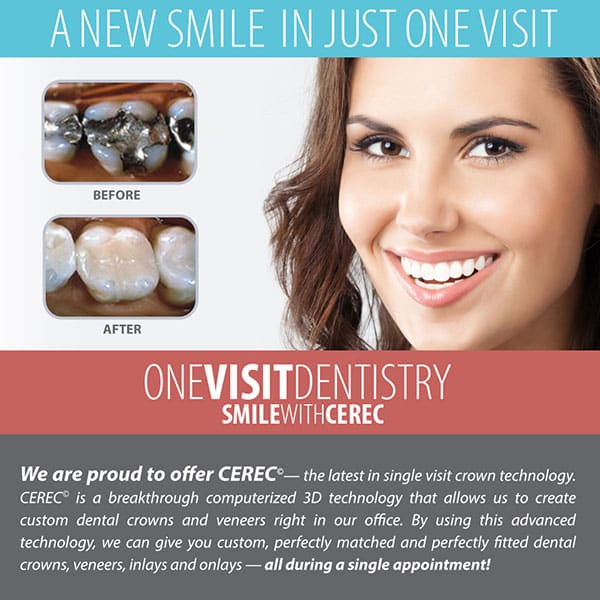 How Do CEREC® and Lab Crowns Differ