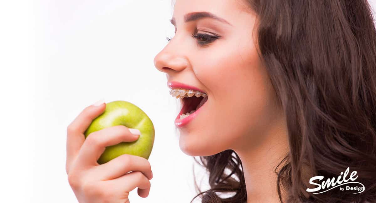 Which Foods Should I Avoid While Wearing Braces?