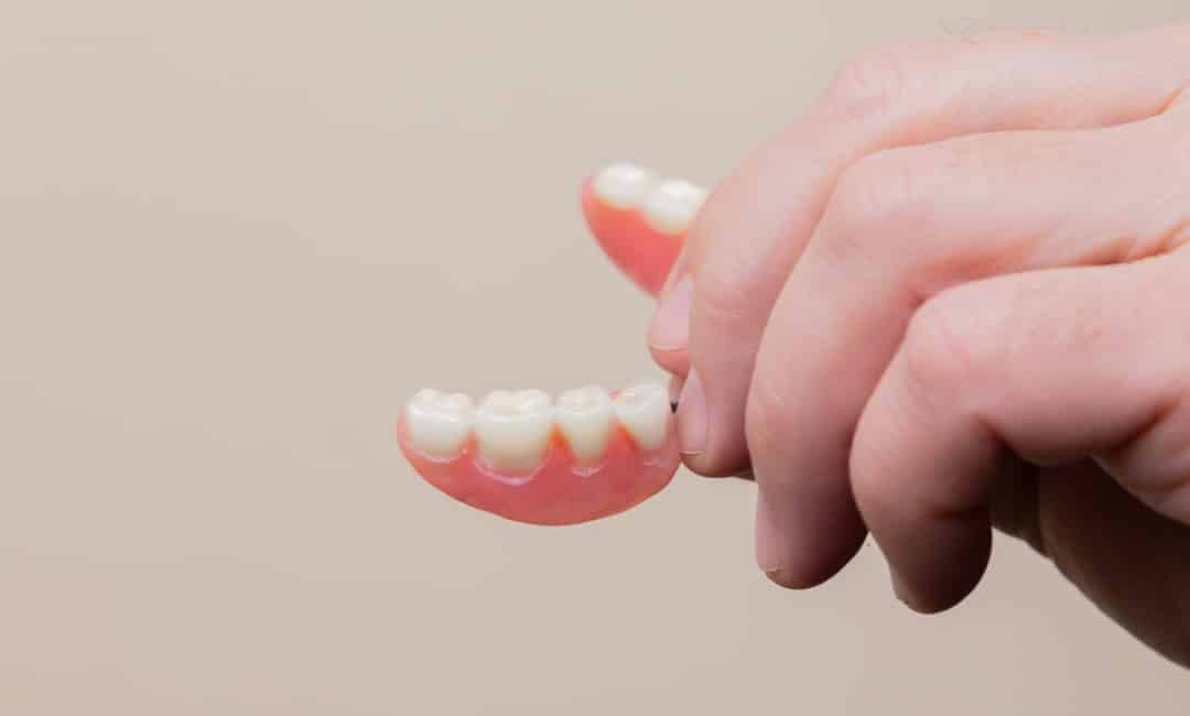 Everything You Need to Know About Dentures
