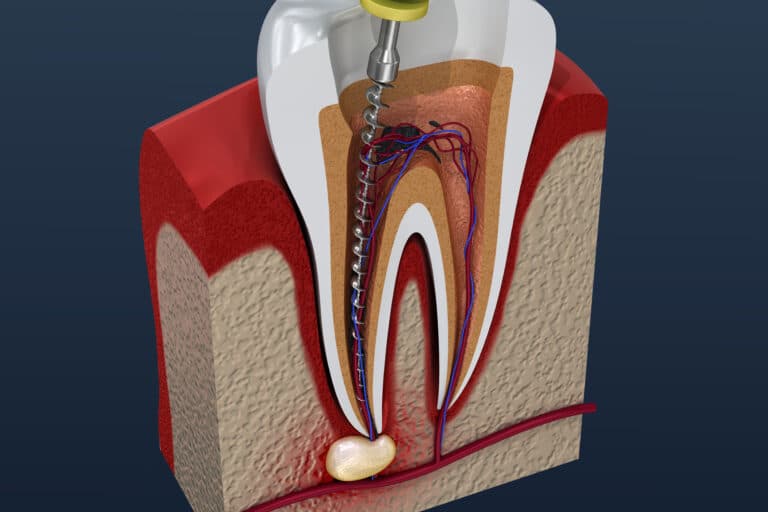 types of dental procedures