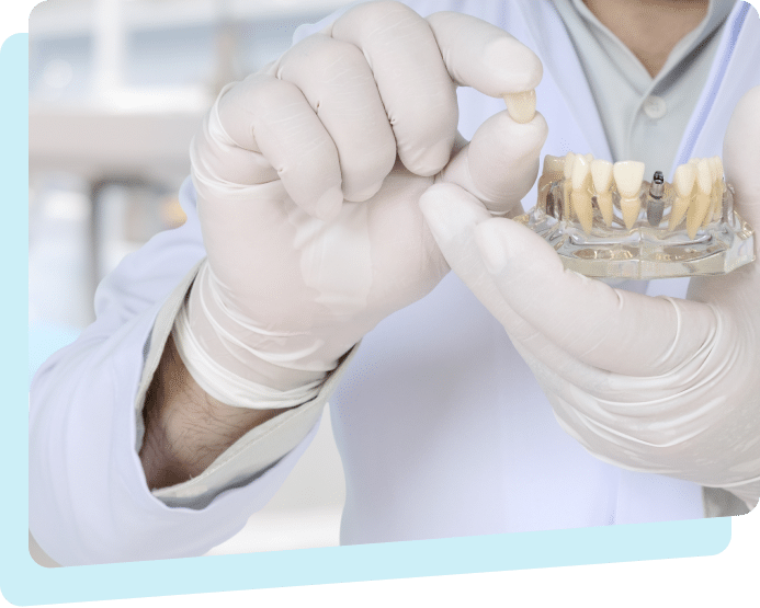 Implant-Supported Dentures in Mississauga