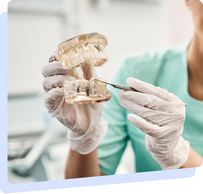 All-on-4™ – Teeth in a Day in Mississauga