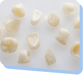 Porcelain Crowns in Mississauga