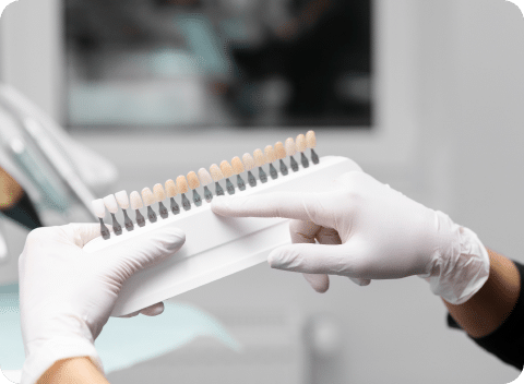 Cosmetic Dental Bonding in Mississauga