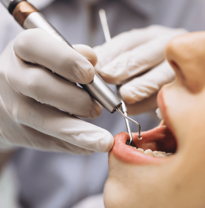 Restorative Dentistry in Mississauga