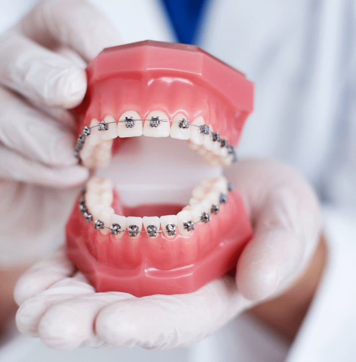 Orthodontists in Mississauga, ON