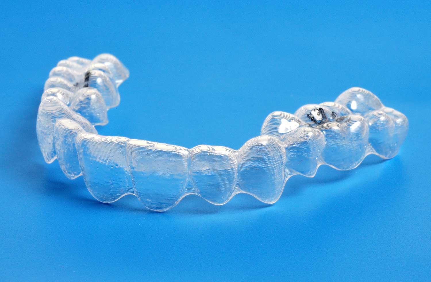 Are There Alternatives to Invisalign?