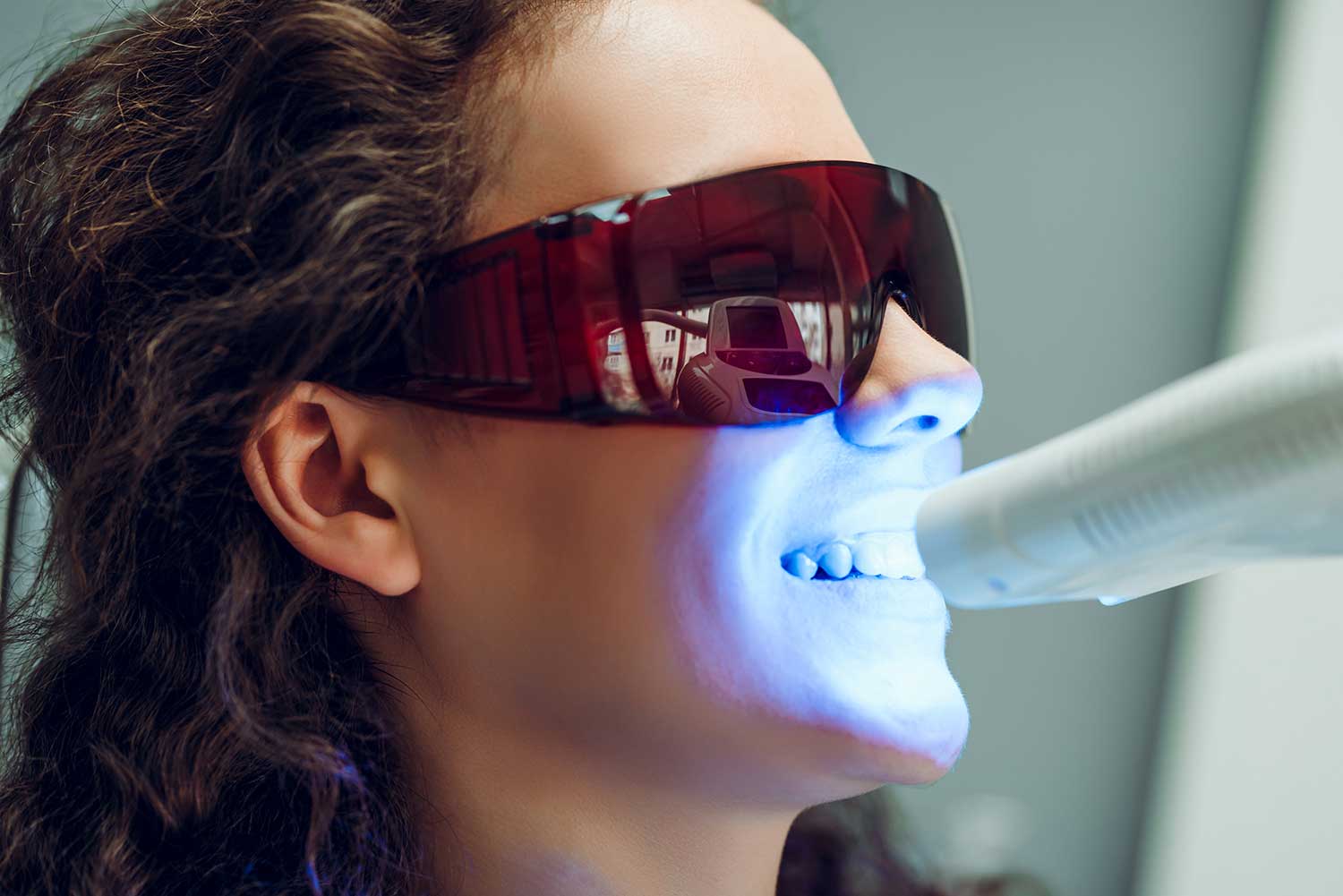 Professional Teeth Whitening in Mississauga