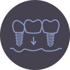 Multiple Missing Teeth Replacement