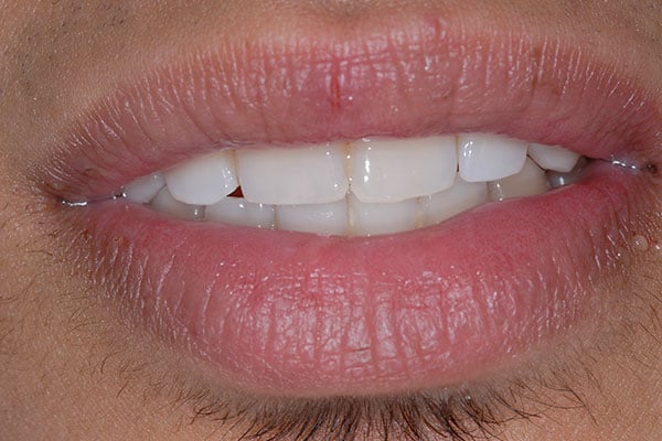 The power of a beautiful smile: cosmetic dentistry before and after