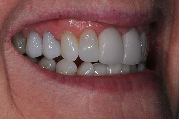 teeth cosmetic dentistry