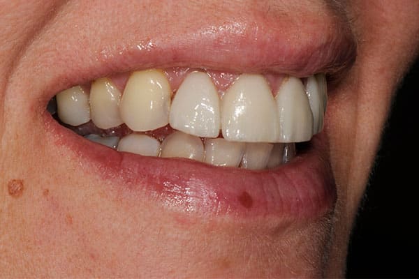 Mississauga dental transformation