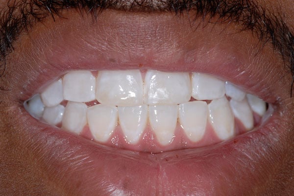 dental transformation