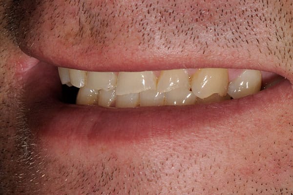 Cosmetic dental surgery for a stunning smile