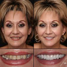 Dentist-in-Mississauga-Cites-Innovative-Anti-Aging-Face-Lift-Dentistry
